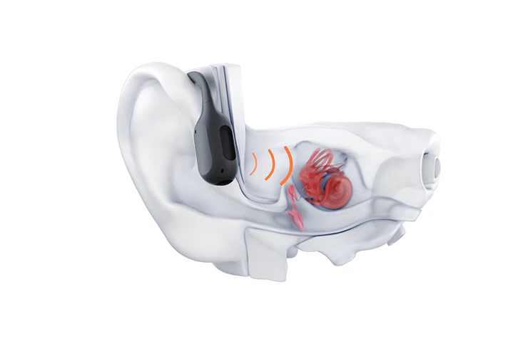 Bone Conduction Ranger What is Bone Conduction vs. Air Conduction? – NOVE Malaysia